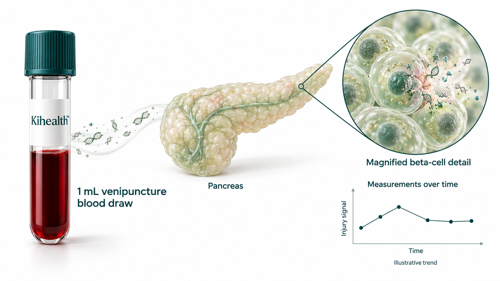 Beta Intercept: a one millilitre blood draw, the pancreas, magnified beta-cell injury and the resulting signal measured over time